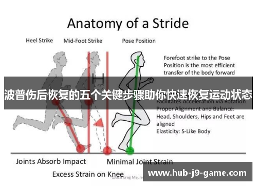 波普伤后恢复的五个关键步骤助你快速恢复运动状态 波普伤后恢复的五个关键步骤助你快速恢复运动状态
